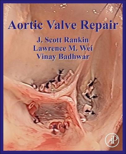 Arterial Variations in Man: Classification and Frequency