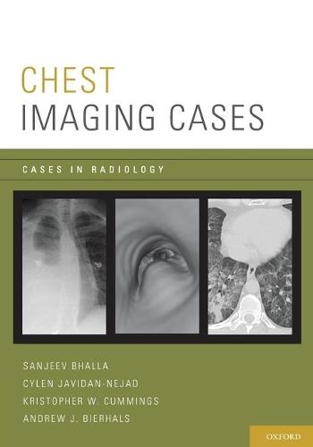 Chest Imaging Cases  by Sanjeev Bhalla (Associate Professor, Radiology, Associate Professor, Radiology, Washington University School of Medicine in St. Louis, St. Louis, Missouri) at Abbey's Bookshop, 