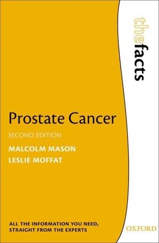 Prostate Cancer  by Malcolm Mason (Cancer Research Wales Professor of Clinical Oncology, Cardiff University) at Abbey's Bookshop, 