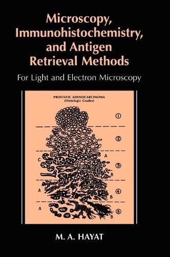 Microscopy, Immunohistochemistry, and Antigen Retrieval Methods: For Light and Electron Microscopy