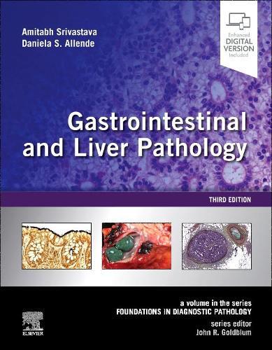 Pocket Gastroenterology and Hepatology: Your compact guide to Gastroenterology and Hepatology: practical, concise, and a clinical lifeline.
