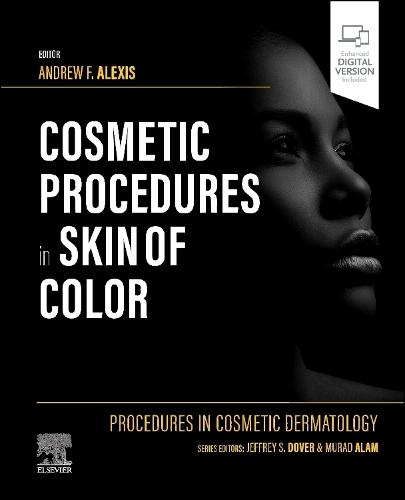 Procedures in Cosmetic Dermatology: Cosmetic Procedures in Skin of Color  by Andrew F. Alexis (Professor, Clinical Dermatology and Vice-Chair for Diversity and Inclusion, Weill Cornell Medicine, New York, NY, USA) at Abbey's Bookshop, 