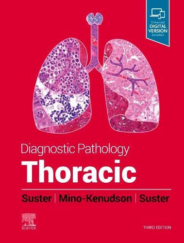 O'tkir Karanar Sindromda Tashxislash Usullari Va Differensial Diagnostika Qilish Taktikasi: (Diagnostic Methods and Differential Diagnostic Tactics in Acute Coronary Syndrome)