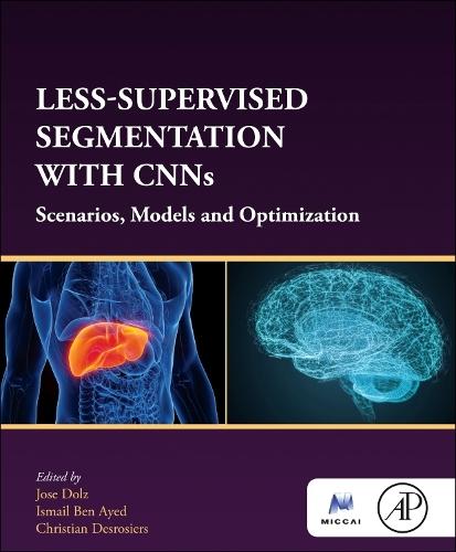 Less-Supervised Segmentation with CNNs: Scenarios, Models and Optimization  by Jose Dolz (Associate Professor, Department of Software and IT Engineering, ETS Montreal, Canada) at Abbey's Bookshop, 