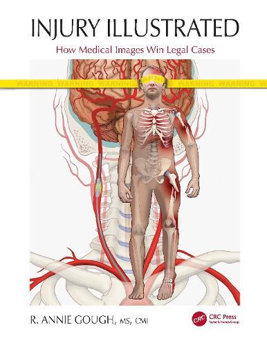 Injury Illustrated: How Medical Images Win Legal Cases  by R. Annie Gough at Abbey's Bookshop, 