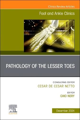 Pathology of the Lesser Toes, An issue of Foot and Ankle Clinics of North America  by Caio Nery, DR (Associate Professor<br>O&T Department<br>Federal University of São Paulo<br>Escola Paulista de Medicina, Brazil) at Abbey's Bookshop, 