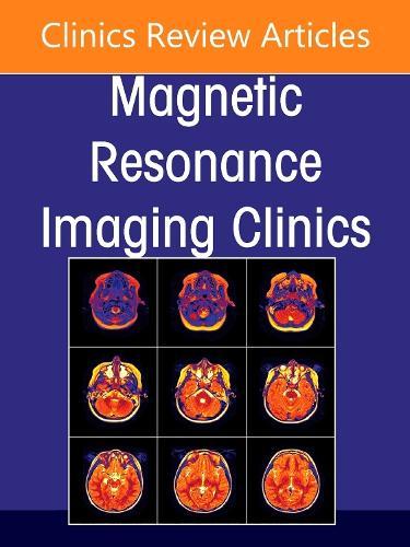 Plexus and Peripheral Nerve MR Imaging: Advances and Applications, An Issue of Magnetic Resonance Imaging Clinics of North America  by Laura M. Fayad, MD (Professor of Radiology, Orthopaedic Surgery & Oncology, Chief of Musculoskeletal Imaging, The Johns Hopkins Medical Institutions, Department of Radiology, Baltimore, MD, USA) at Abbey's Bookshop, 