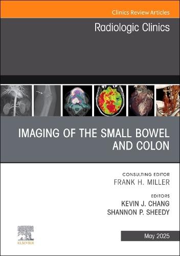 Imaging of the Small Bowel and Colon, An Issue of Radiologic Clinics of North America  by Kevin J. Chang, MD, FACR, FSAR (Section Chief of Abdominal Imaging &Director of MRI, Department of Radiology, Boston Medical Center, Boston, MA, USA) at Abbey's Bookshop, 