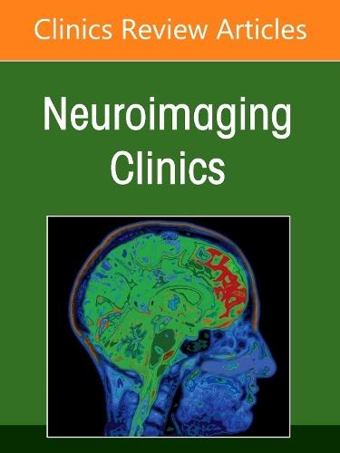 Management and Treatment of Cerebral Aneurysms, An Issue of Neuroimaging Clinics of North America  by Daniel Sahlein, MD (Goodman Campbell Brain and Spine, Carmel, IN, USA) at Abbey's Bookshop, 