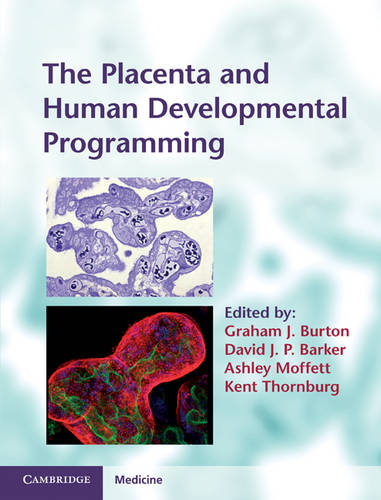 The Placenta and Human Developmental Programming  by Graham J. Burton at Abbey's Bookshop, 