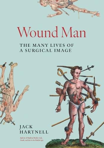 Wound Man: The Many Lives of a Surgical Image  by Jack Hartnell at Abbey's Bookshop, 