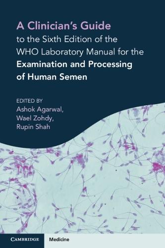The Cause and Control of Sex in Humanspring
