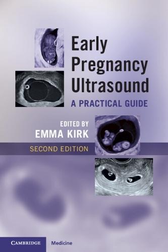 Early Pregnancy Ultrasound: A Practical Guide