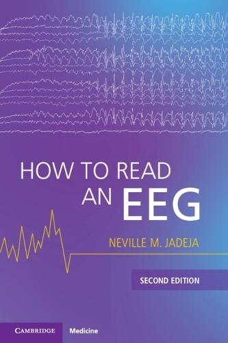 How to Read an EEG  by Neville M. Jadeja (UMass Chan Medical School) at Abbey's Bookshop, 