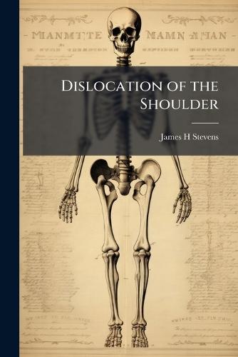 Dislocation of the Shoulder  by James H Stevens at Abbey's Bookshop, 