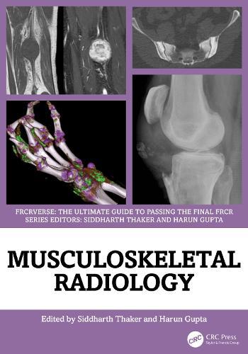 Musculoskeletal Radiology: An Ultimate Guide to Passing the Final FRCR  by Siddharth Thaker (Manchester University Hospitals, UK) at Abbey's Bookshop, 
