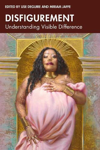 Disfigurement: Understanding Visible Difference  by Lise Deguire at Abbey's Bookshop, 