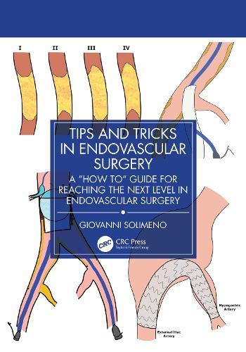 Tips and Tricks in Endovascular Surgery: A ""How to"" Guide for reaching the next Level in Endovascular Surgery  by Giovanni Solimeno at Abbey's Bookshop, 