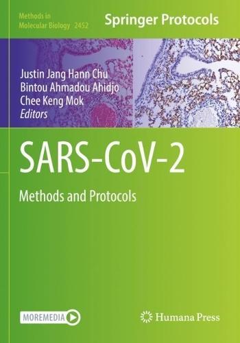SARS-CoV-2: Methods and Protocols  by Justin Jang Hann Chu at Abbey's Bookshop, 