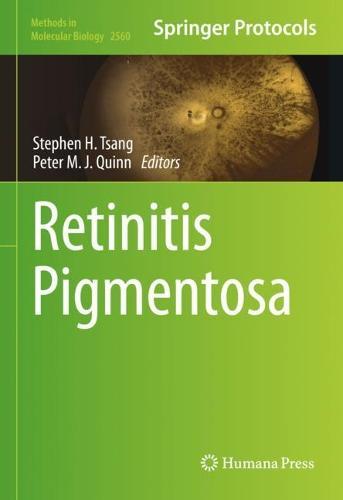 Retinitis Pigmentosa  by Stephen H. Tsang at Abbey's Bookshop, 