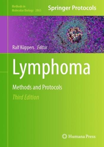 Lymphoma: Methods and Protocols  by Ralf Küppers at Abbey's Bookshop, 