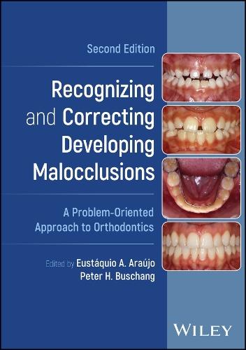 Recognizing and Correcting Developing Malocclusions: A Problem-Oriented Approach to Orthodontics  by Eustáquio A. Araújo (Saint Louis University, Saint Louis, Missouri, USA) at Abbey's Bookshop, 