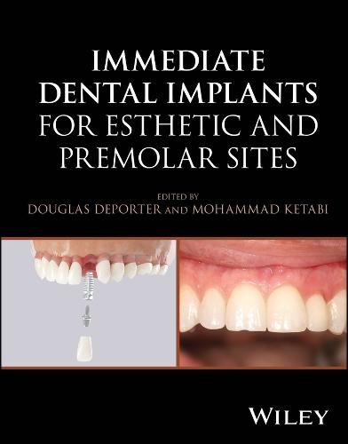 Immediate Dental Implants for Esthetic and Premolar Sites  by Douglas Deporter (University of Toronto, ON, Canada) at Abbey's Bookshop, 
