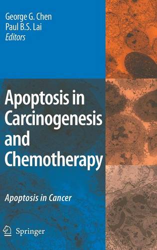 44 Recetas de Jugos Para Prevenir Ataques Cardíacos: La Solución Casera de los Sobrevivientes de Ataques Cardíacos Para Una Mejor Vida