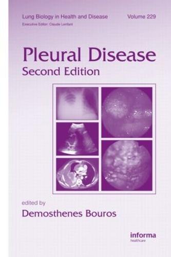 Pleural Disease  by Demosthenes Bouros (Democritus University, Alexandroupolis, Greece) at Abbey's Bookshop, 