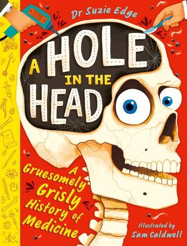 A Hole in the Head: A gruesomely grisly history of medical firsts  by Suzie Edge at Abbey's Bookshop, 