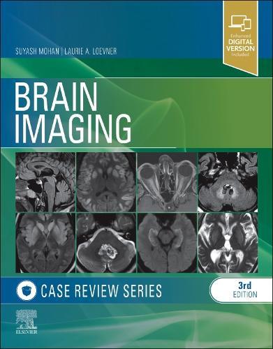 AI in Diagnostic Radiology: Clinical Applications and Case-Based Insights