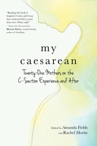 My Caesarean: Twenty-One Mothers on the C-Section Experience and After  by Amanda Fields at Abbey's Bookshop, 