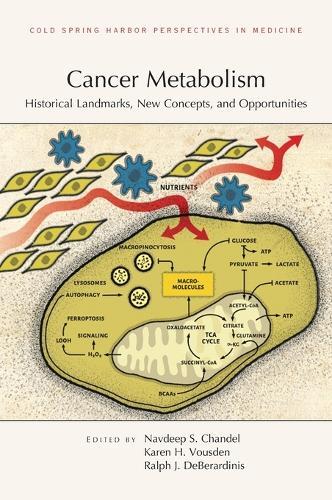 Cancer Metabolism: Historical Landmarks, New Concepts, and Opportunities  by Ralph J Deberardinis at Abbey's Bookshop, 