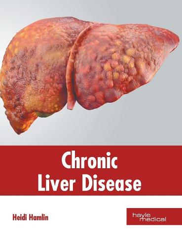 Diagnosis and Treatment of Liver Fibrosis