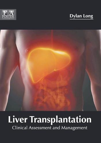 Liver Transplantation: Clinical Assessment and Management  by Dylan Long at Abbey's Bookshop, 