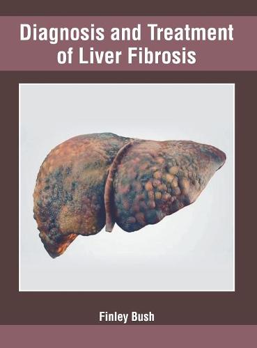 Diagnosis and Treatment of Liver Fibrosis