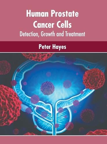 Human Prostate Cancer Cells: Detection, Growth and Treatment  by Peter Hayes at Abbey's Bookshop, 