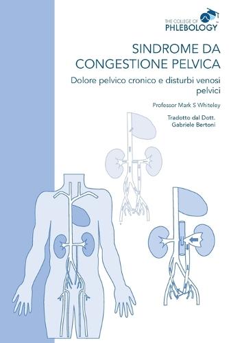 Sindrome da congestione pelvica - Dolore pelvico cronico e disturbi venosi pelvici  by Mark S Whiteley at Abbey's Bookshop, 