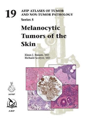 Melanocytic Tumors of the Skin  by Klaus J. Busam at Abbey's Bookshop, 