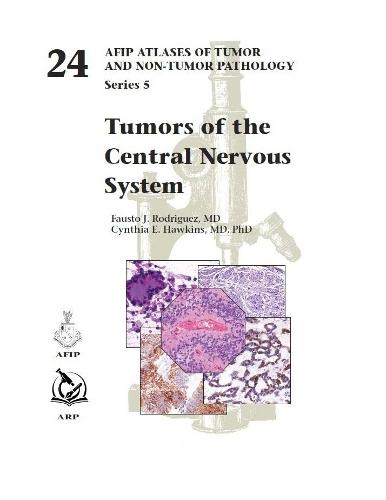 Tumors of the Central Nervous System  by Fausto J. Rodriguez at Abbey's Bookshop, 