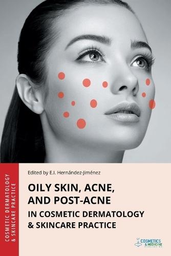 Oily Skin, Acne, and Post-Acne in Cosmetic Dermatology & Skincare Practice  by Elena Hernandez-Jimenez at Abbey's Bookshop, 