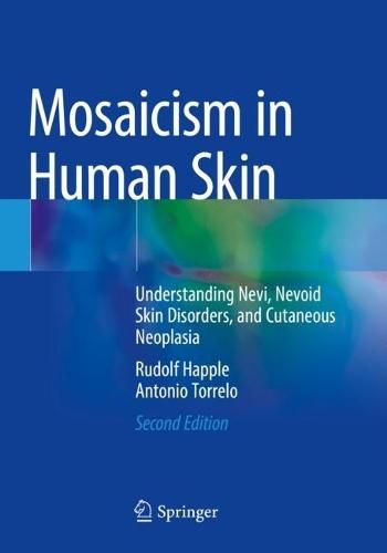 Mosaicism in Human Skin: Understanding Nevi, Nevoid Skin Disorders, and Cutaneous Neoplasia  by Rudolf Happle at Abbey's Bookshop, 