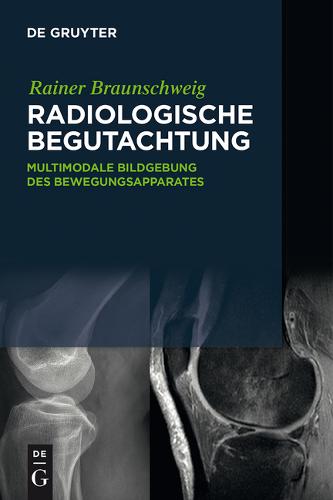 Nuclear Medicine and PET/CT Cases