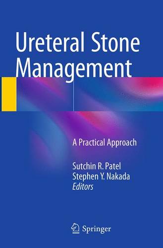Ureteral Stone Management: A Practical Approach