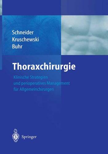 Thoraxchirurgie: Klinische Strategien und perioperatives Management für Allgemeinchirurgen