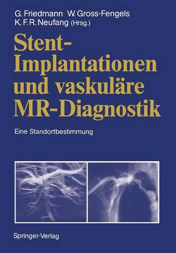 Stent-Implantationen und vaskuläre MR-Diagnostik: Eine Standortbestimmung