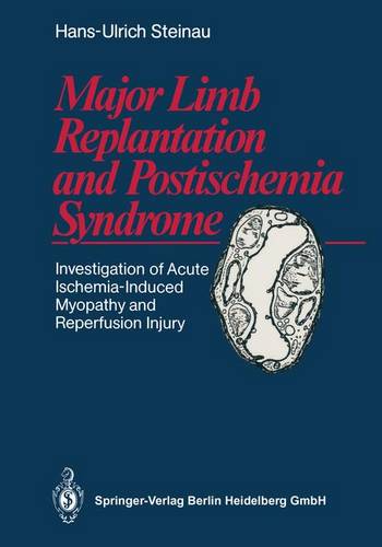 Major Limb Replantation and Postischemia Syndrome: Investigation of Acute Ischemia-Induced Myopathy and Reperfusion Injury