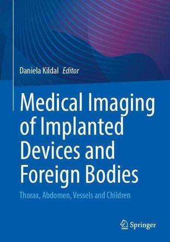 Medical Imaging of Implanted Devices and Foreign Bodies: Thorax, Abdomen, Vessels and Children