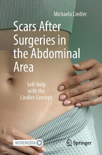 Scars After Surgeries in the Abdominal Area: Self-Help with the Liedler-Concept  by Michaela Liedler at Abbey's Bookshop, 