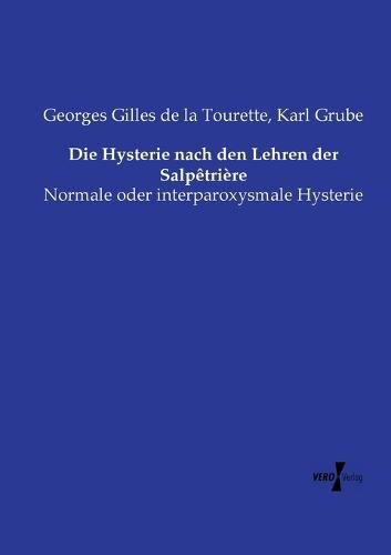 Les calculs de la vessie et la lithotritie